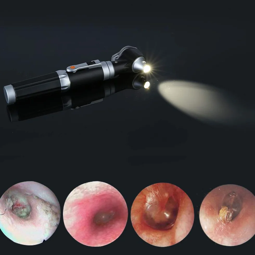 Mini Otoscopio, Bysameyee Magnificación Otoscopio de diagnóstico con luz de iluminación directa de LED, Herramienta para el oído saludable para doctores Enfermeras Adultos Niños Bebé Anciano Mascotas