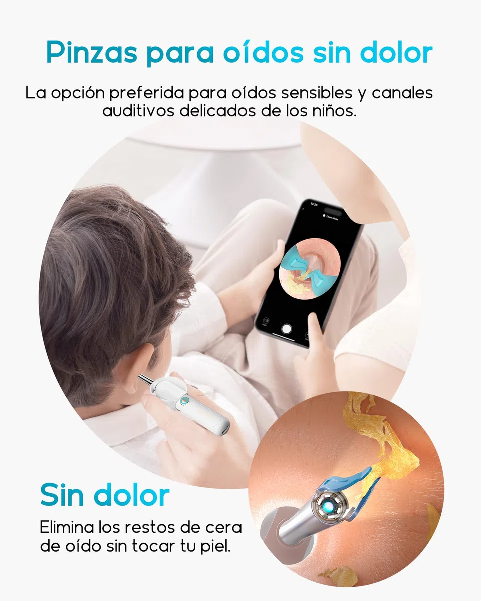 BEBIRD Otoscopio Orecchio, 1080P HD 3,5mm Camera Orecchio, Otoscopio Endoscopio Fotocamera 4,5mm WIFI con 6 LED regolabili per Tablet Android iOS - Bianco