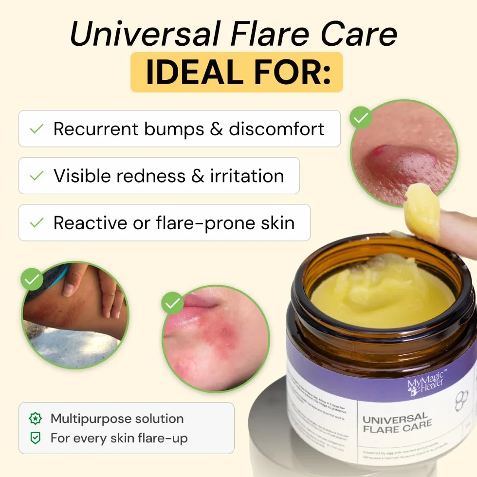 MyMagicHealer Universal Flare Care - Pomada extractora para HS, forúnculos, quistes, hemorroides, quiste pilonidal, absceso, antirozaduras, cuidado de heridas, alivio para el picor de piel con