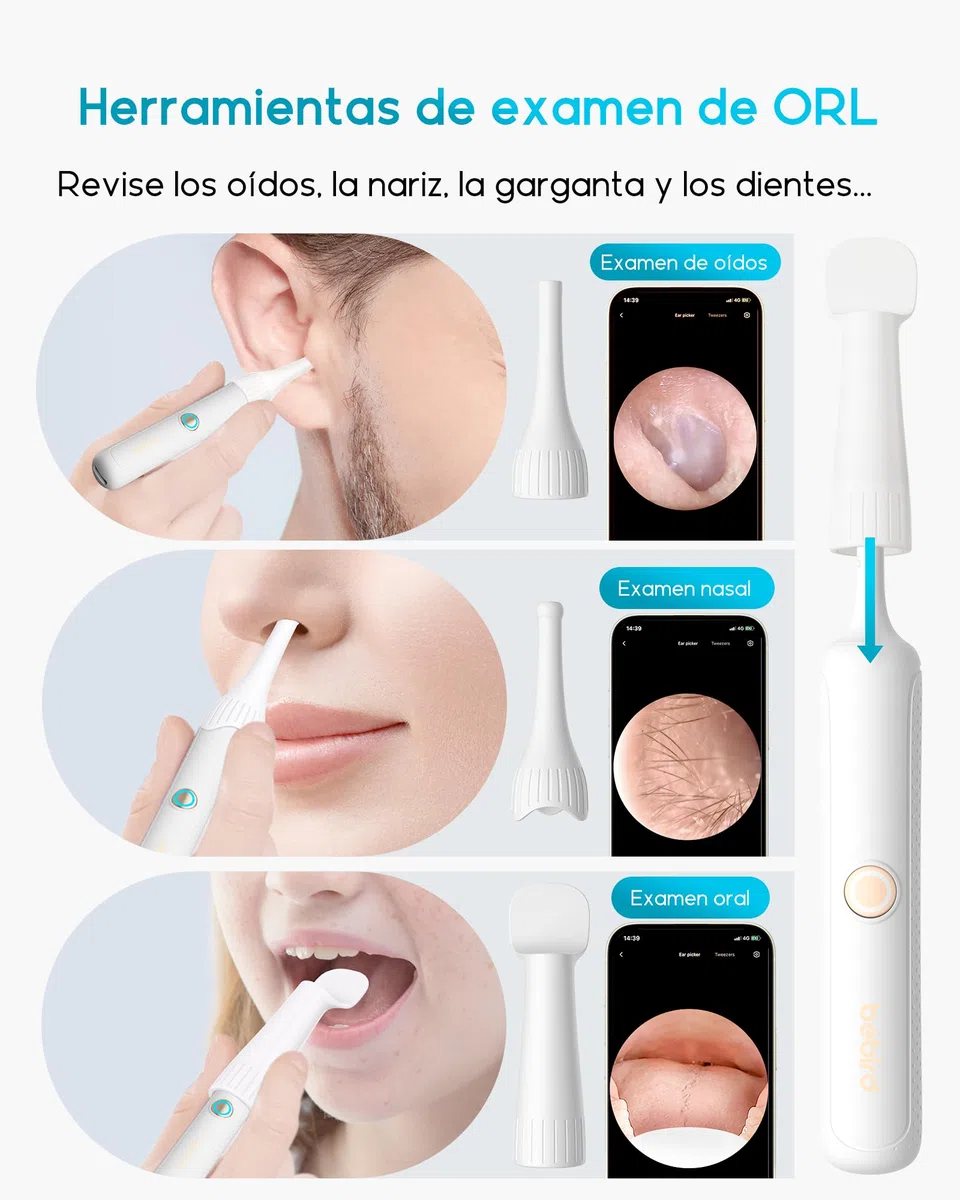 BEBIRD Otoscopio Orecchio, 1080P HD 3,5mm Camera Orecchio, Otoscopio Endoscopio Fotocamera 4,5mm WIFI con 6 LED regolabili per Tablet Android iOS - Bianco