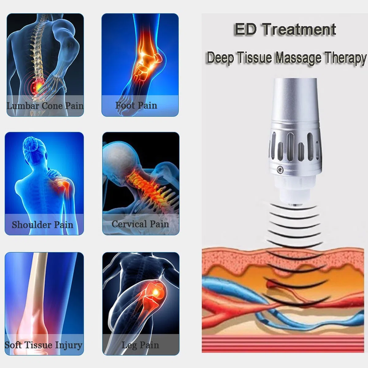 Onda de Choque Fisioterapia, Terapia Ondas de Choque Disfuncion Erectil, Electromagnética Extracorpóreas eswt shockwave therapy machine para fascitis plantar, calcificación, celulitis