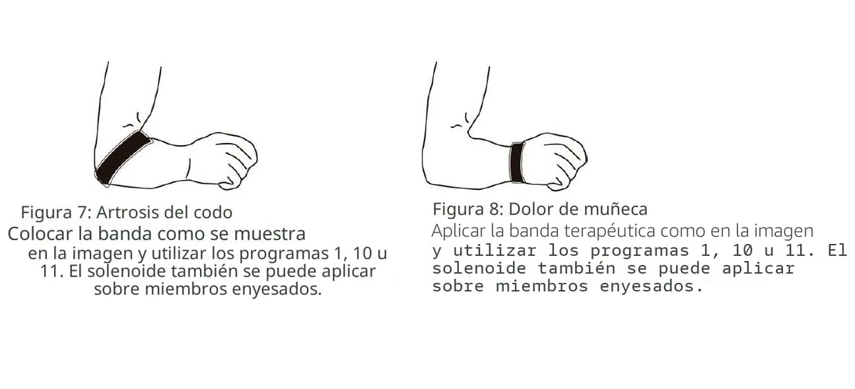 Magnetoterapia con bandas de solenoide CEM MAF para terapia analgésica