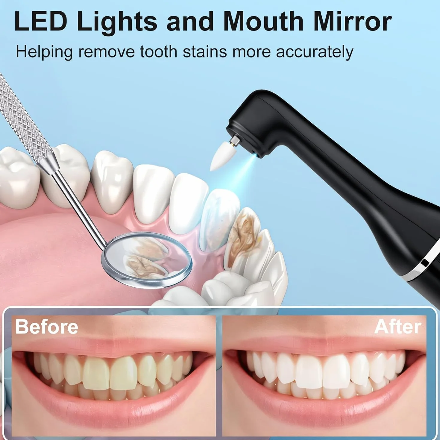 Kit Blanqueamiento Dientes, Pulidor eléctrico de dientes, Limpiador Sarro Dental,Para Limpieza Dental,Blanqueamiento Dental Reduce la Placa, IPX6 Resistente al Agua Negro