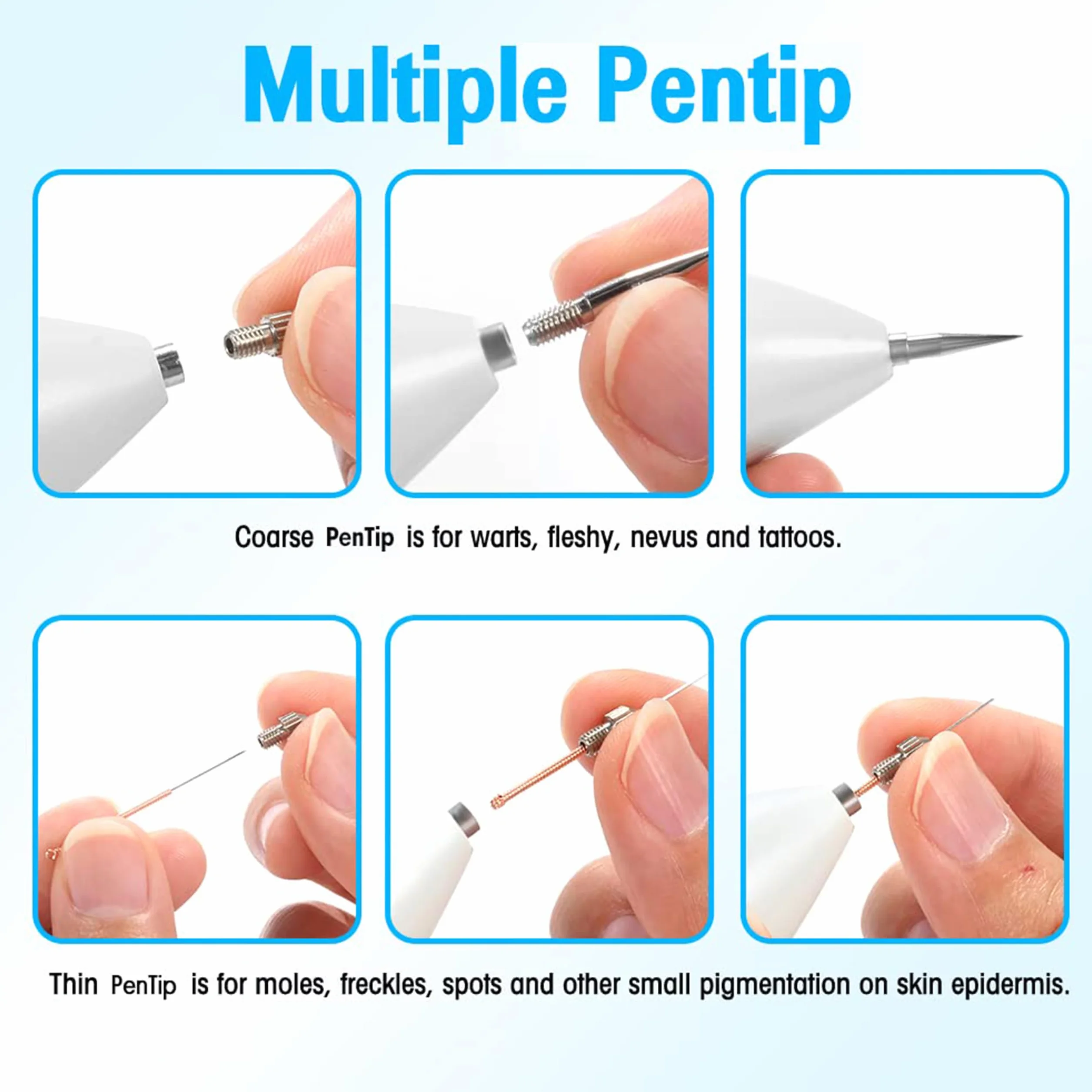 Eliminación de marcas de nacimiento verrugas bolígrafo almidón cara manos