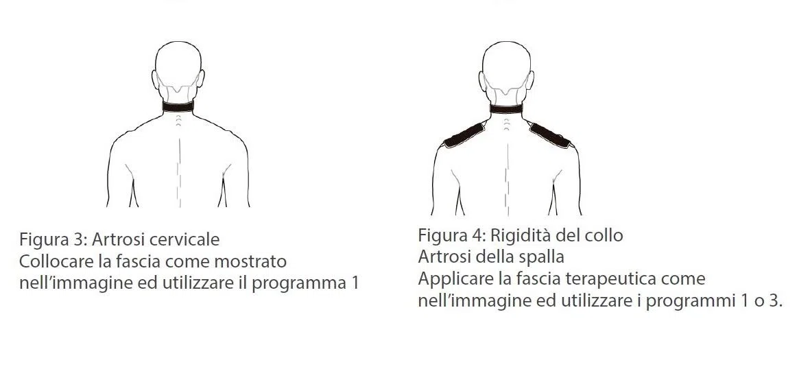 Magnetoterapia con bandas de solenoide CEM MAF para terapia analgésica