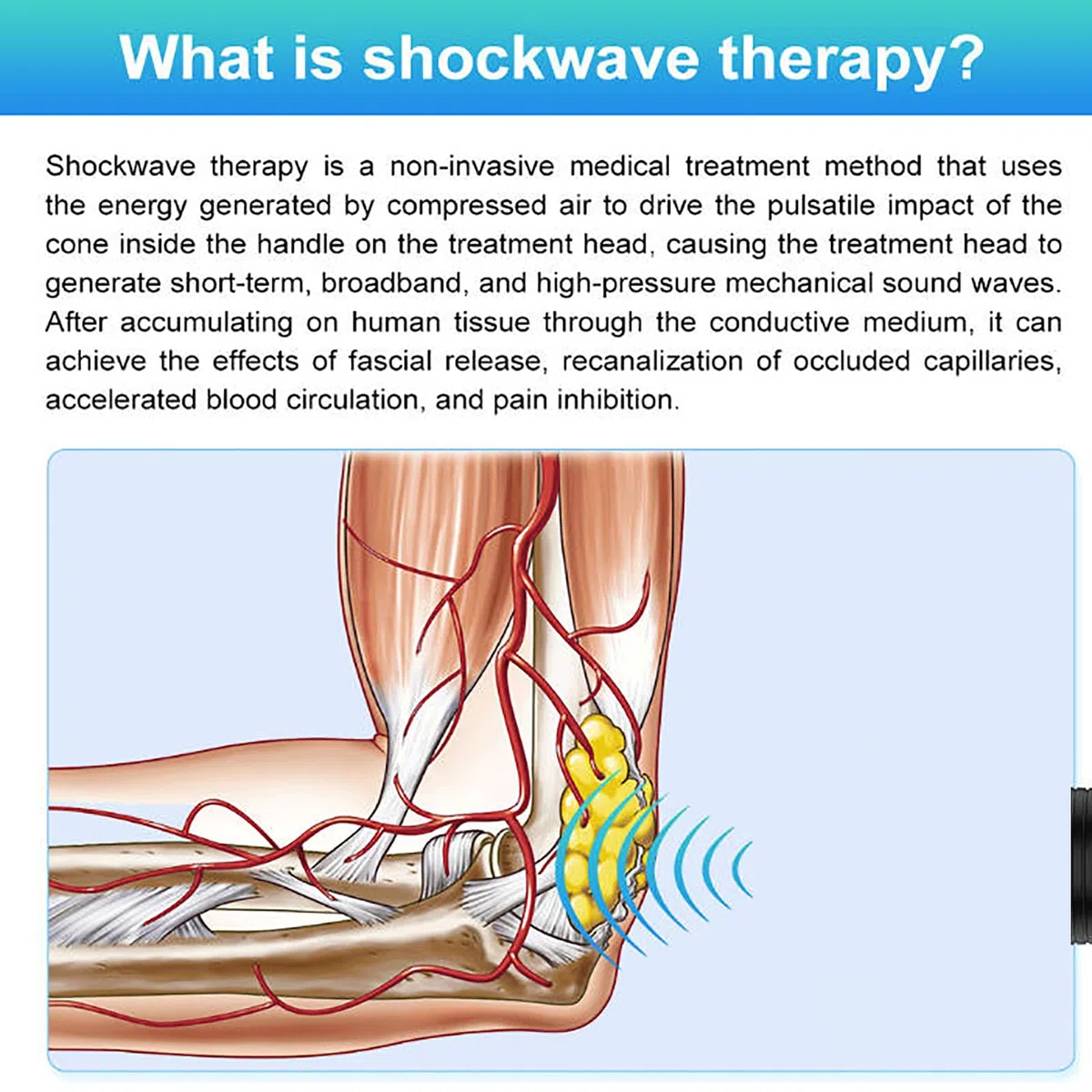 Máquina Terapia Ondas Choque, Dispositivo Terapia Ondas Choque ED Con 1 Mango Y 7 Sondas,frecuencia Ajustable 1-18HZ Y Energía 10-300MJ,profundamente En Piel 8cm,no Invasivo, Para El Cuerpo